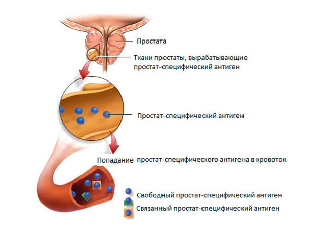 Афала (лекарство от простатита) содержит антитела к ПСА